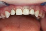 Pediatric-Restorative-Dentistry-After-Image